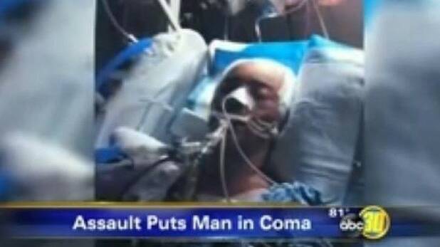 Pacific Palms teacher in coma after US punch