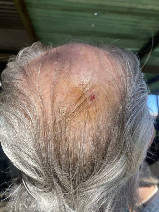 OUCH: Barry Wade was bitten on the head by a mouse as he was sleeping. Photo: Supplied