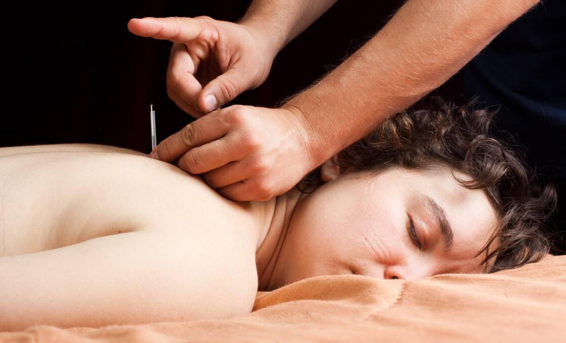 Acupuncture can provide a drug-free way to support health and wellbeing. Picture Shutterstock