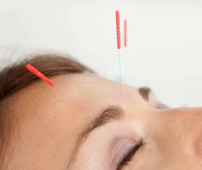 the World Health Organization recognises acupuncture as an effective traditional medicine for dozens of common health problems. Picture Shutterstock